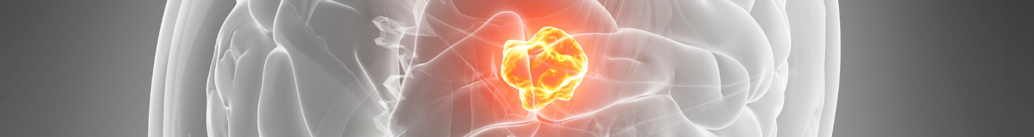 2025 EDW Multidisciplinary Neuro Oncology Tumor Board (RSS) Banner